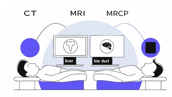 담도암 수술과정