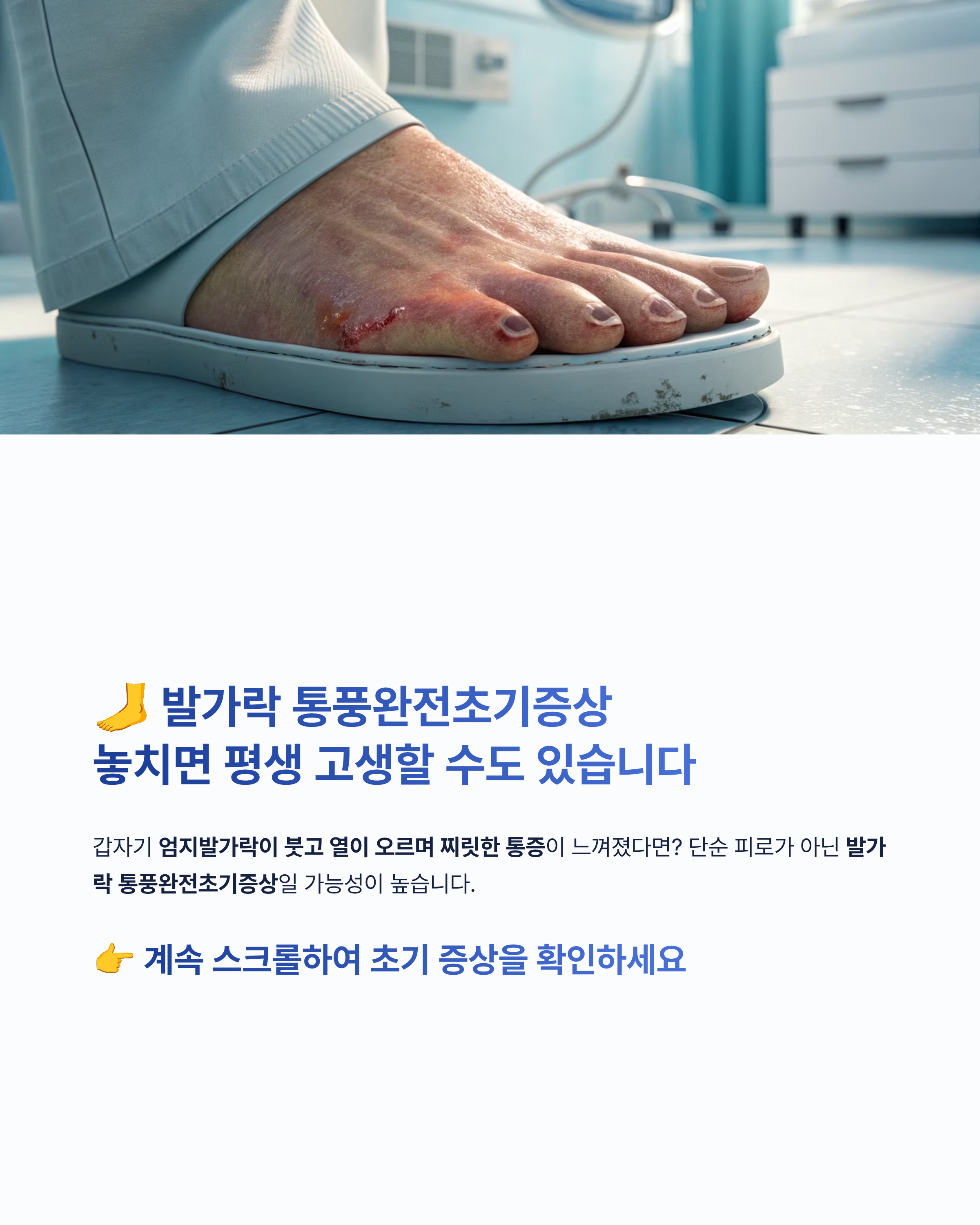 발가락 통풍완전초기증상 알아보기