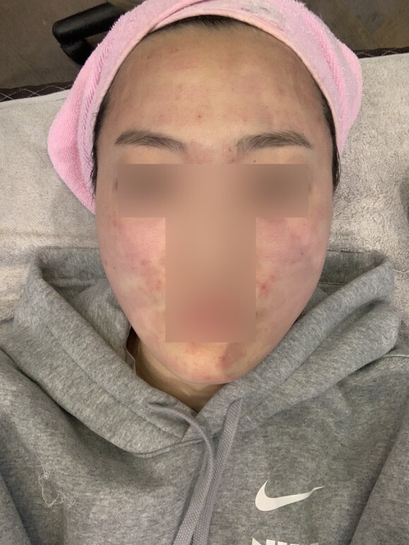 크라이오셀 후기