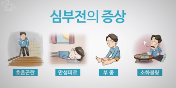 심부전 관리: 증상부터 치료까지 알아야 할 모든 것