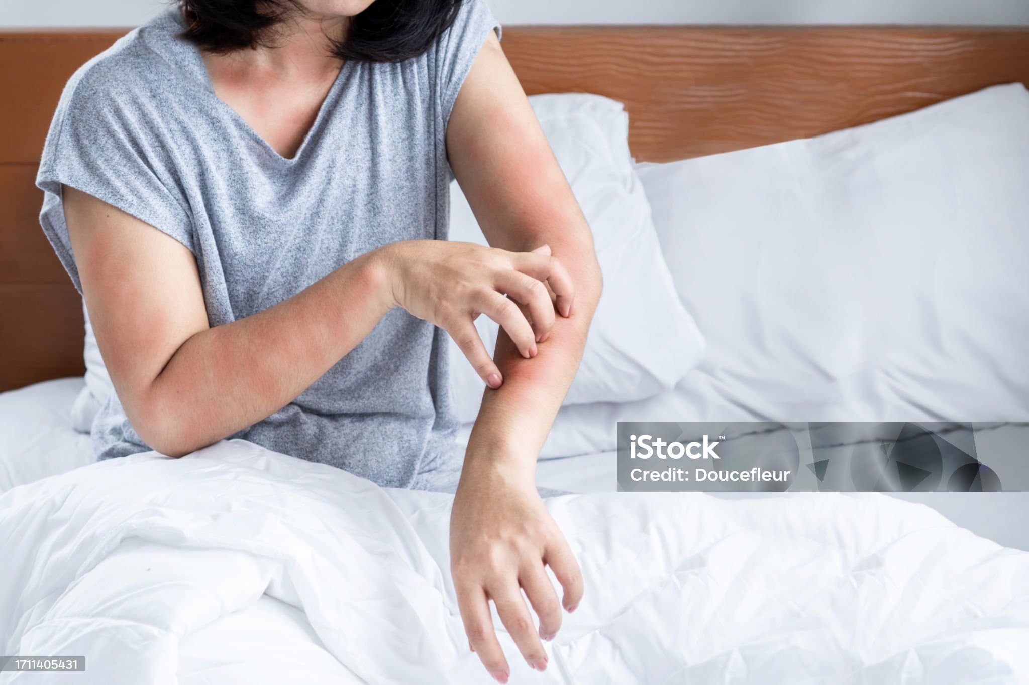 몸이 간지러운 이유&amp;#44; 헷갈리는 알레르기 vs 질환 차이