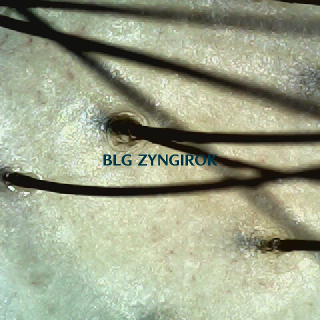 탈모 극복 프로젝트 - 정수리 두피 모습이다.