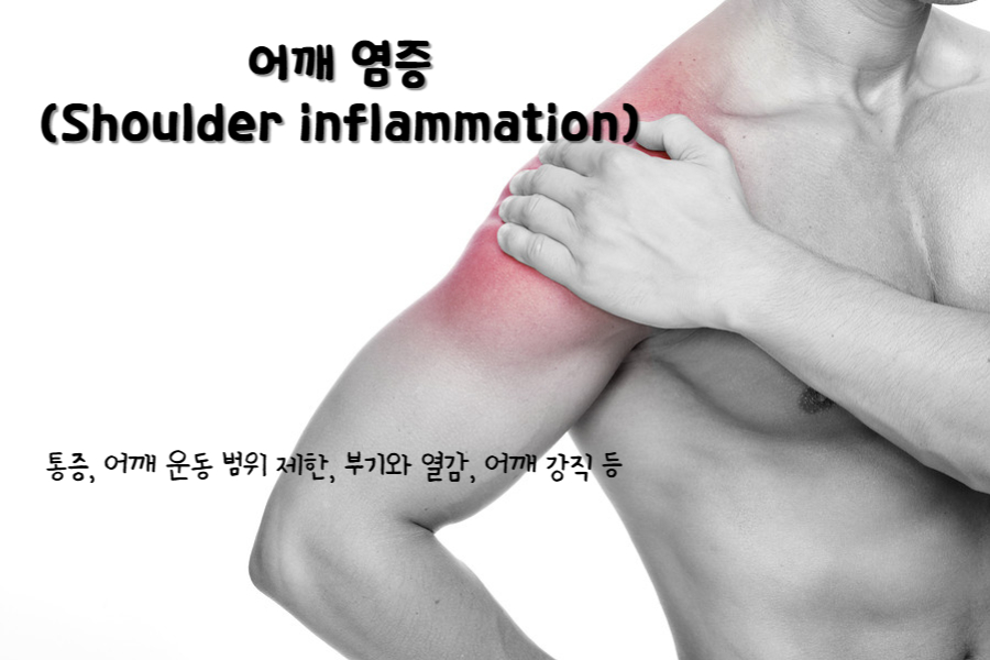 어깨 염증(Shoulder inflammation)
어깨 염증 주요 증상 : 통증, 어깨 운동 범위 제한, 부기와 열감, 어깨 강직 등