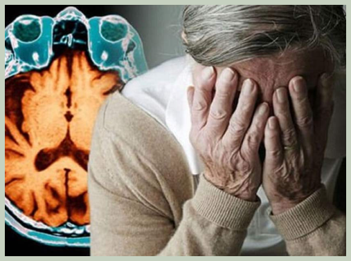 치매 알츠하이머 치료