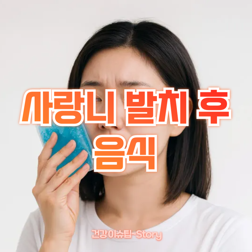 사랑니 발치 후 음식