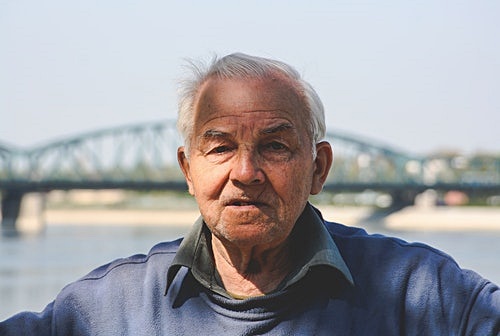 쏘팔메토 장기복용, 탈모에 효과 있을까?