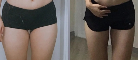 여자-허벅지-얇아지는법