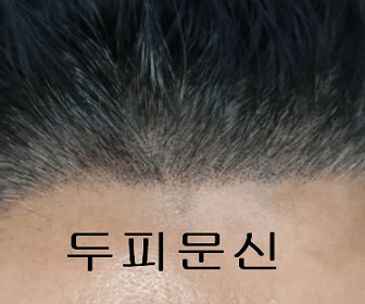 풍성해 보이는 머리카락