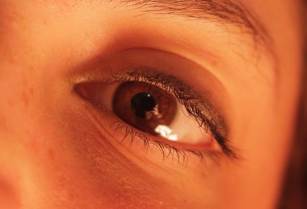 눈이 충혈되는 이유