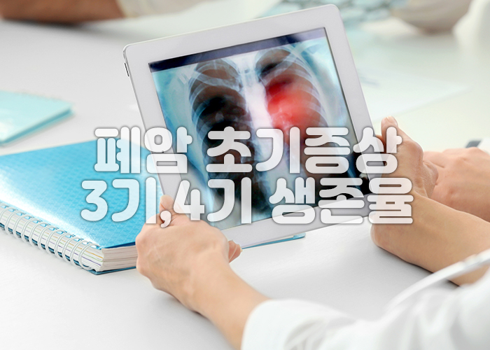 의사가 폐사진을 보고 있다