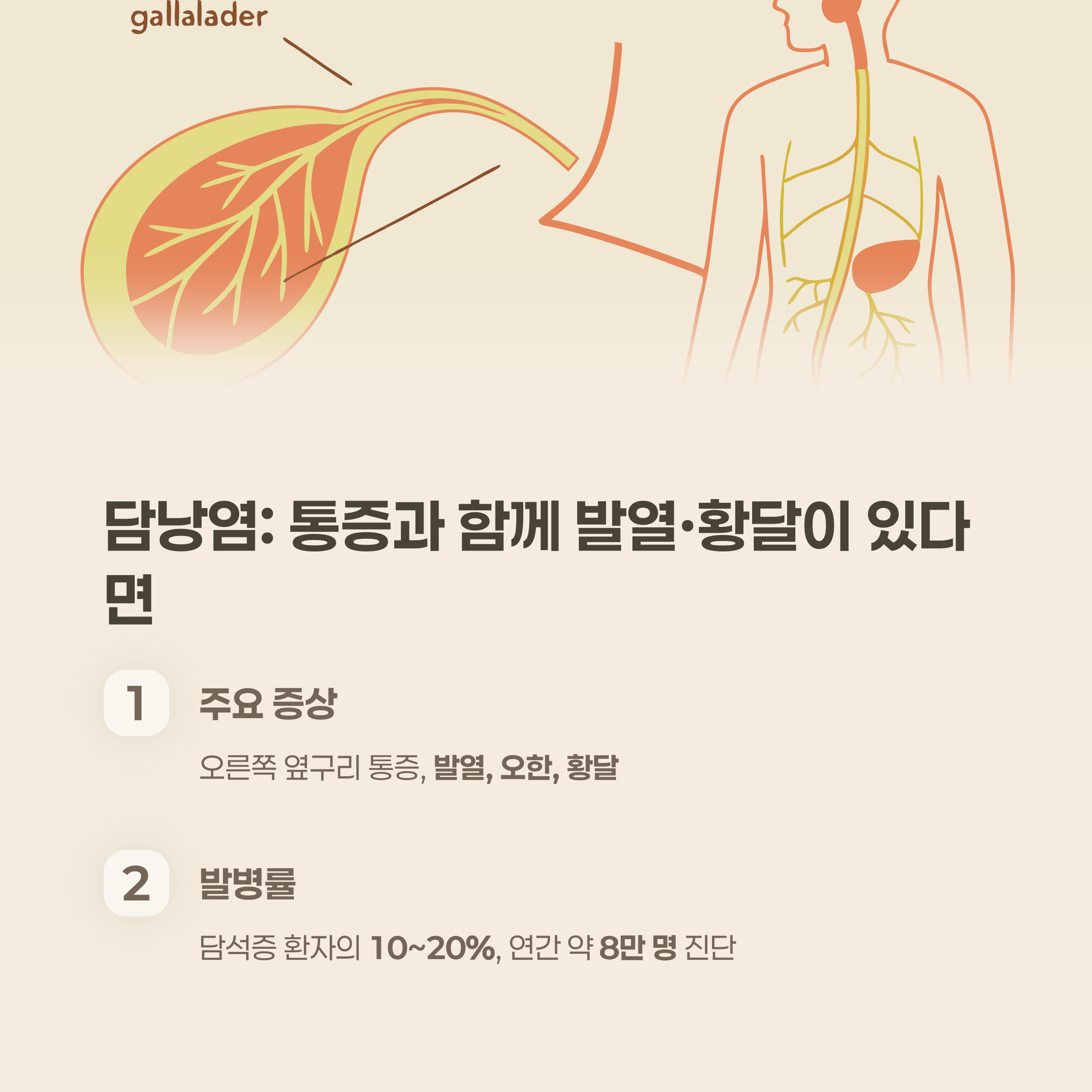 담낭염: 통증과 함께 발열&middot;황달이 있다면
