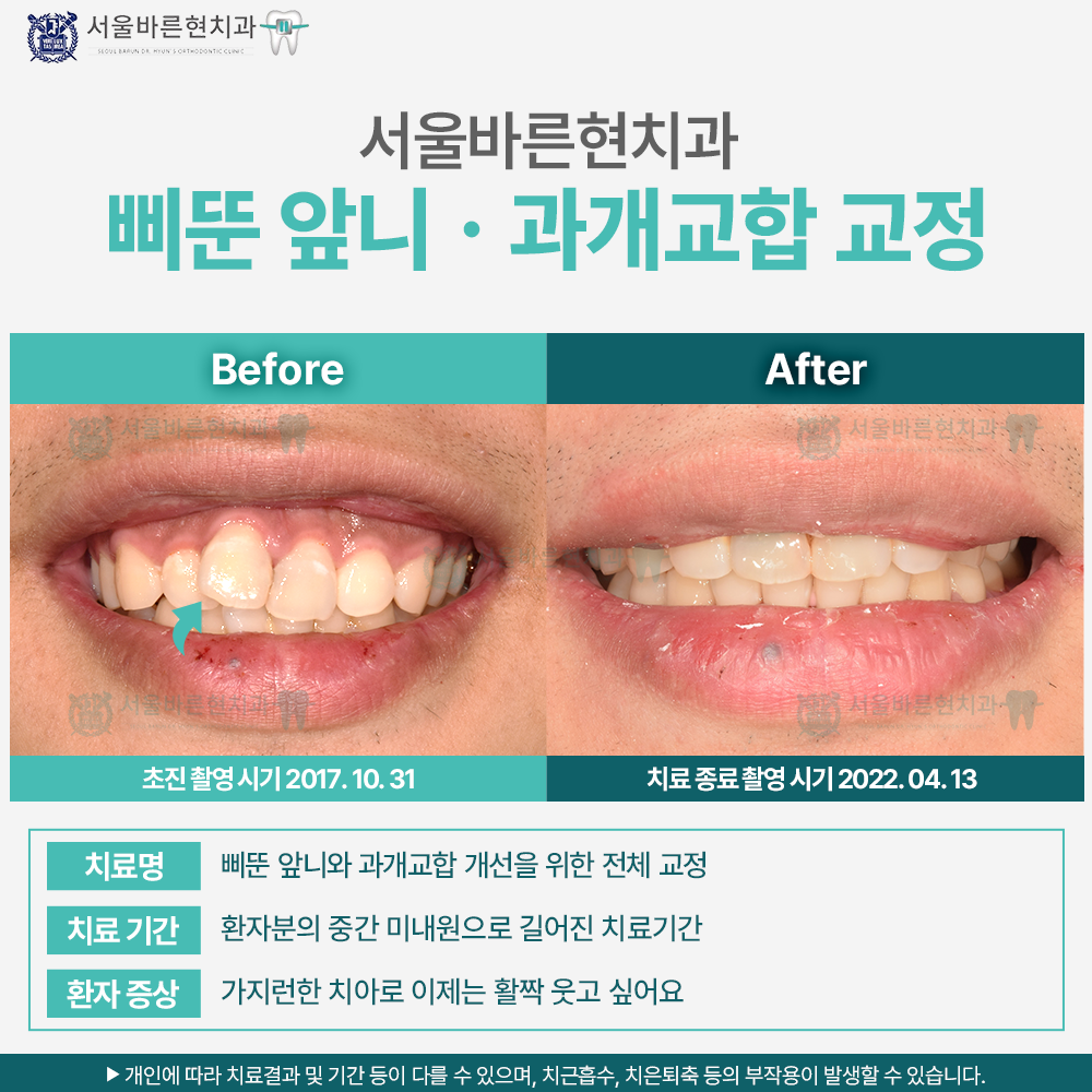해운대교정치과