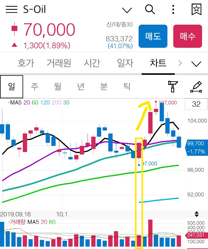 쌍봉 패턴