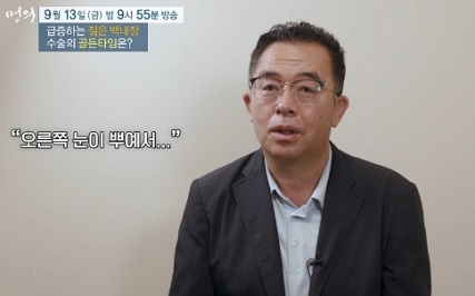 백내장환자