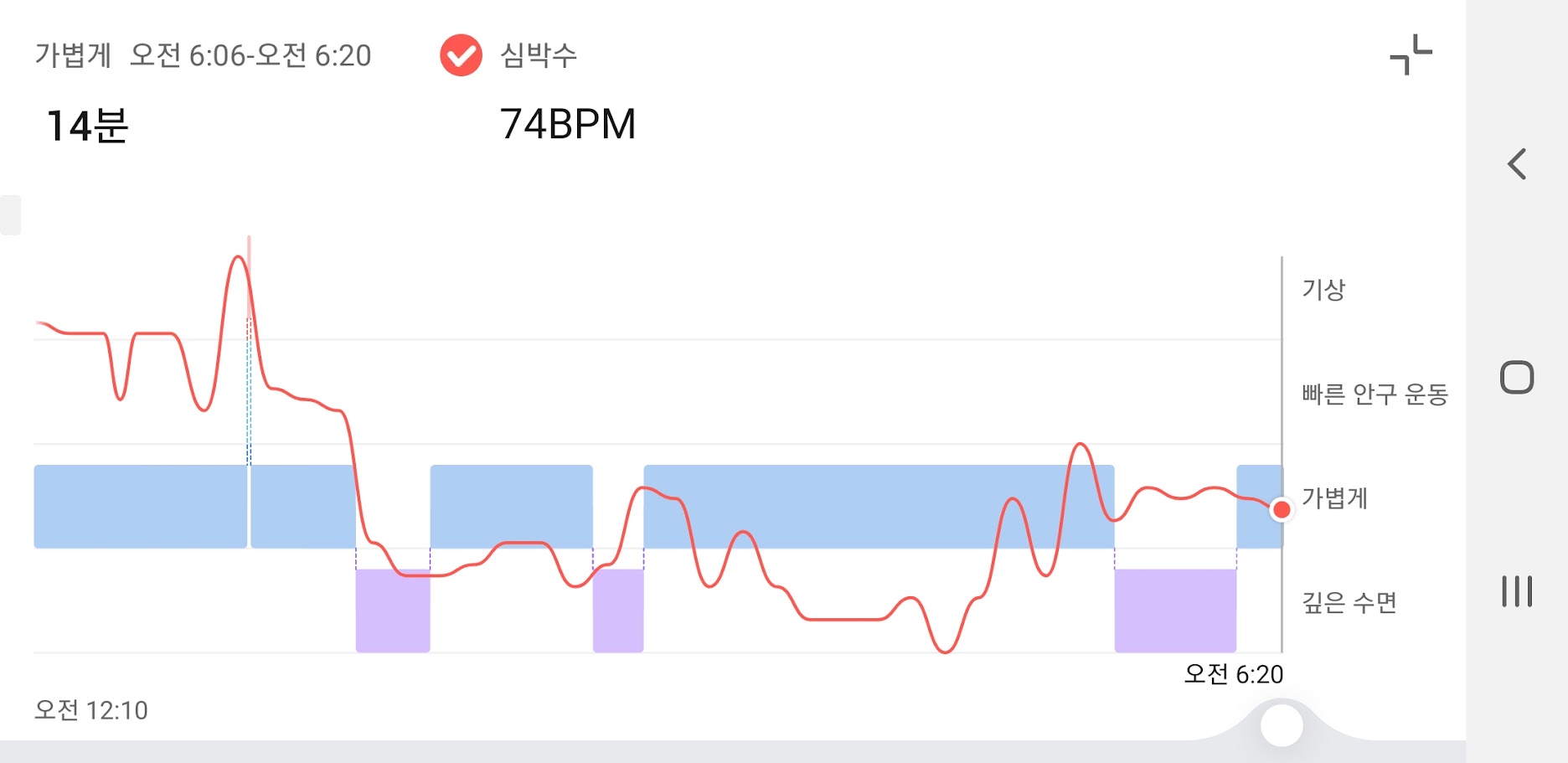 깊은 수면 검사.
