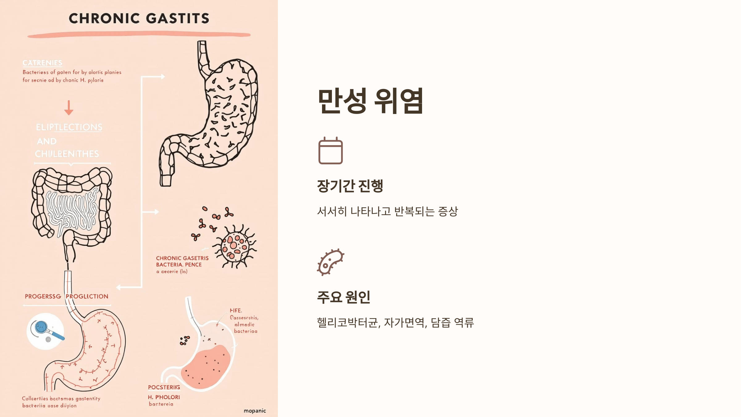 위염 초기증상 사진입니다.