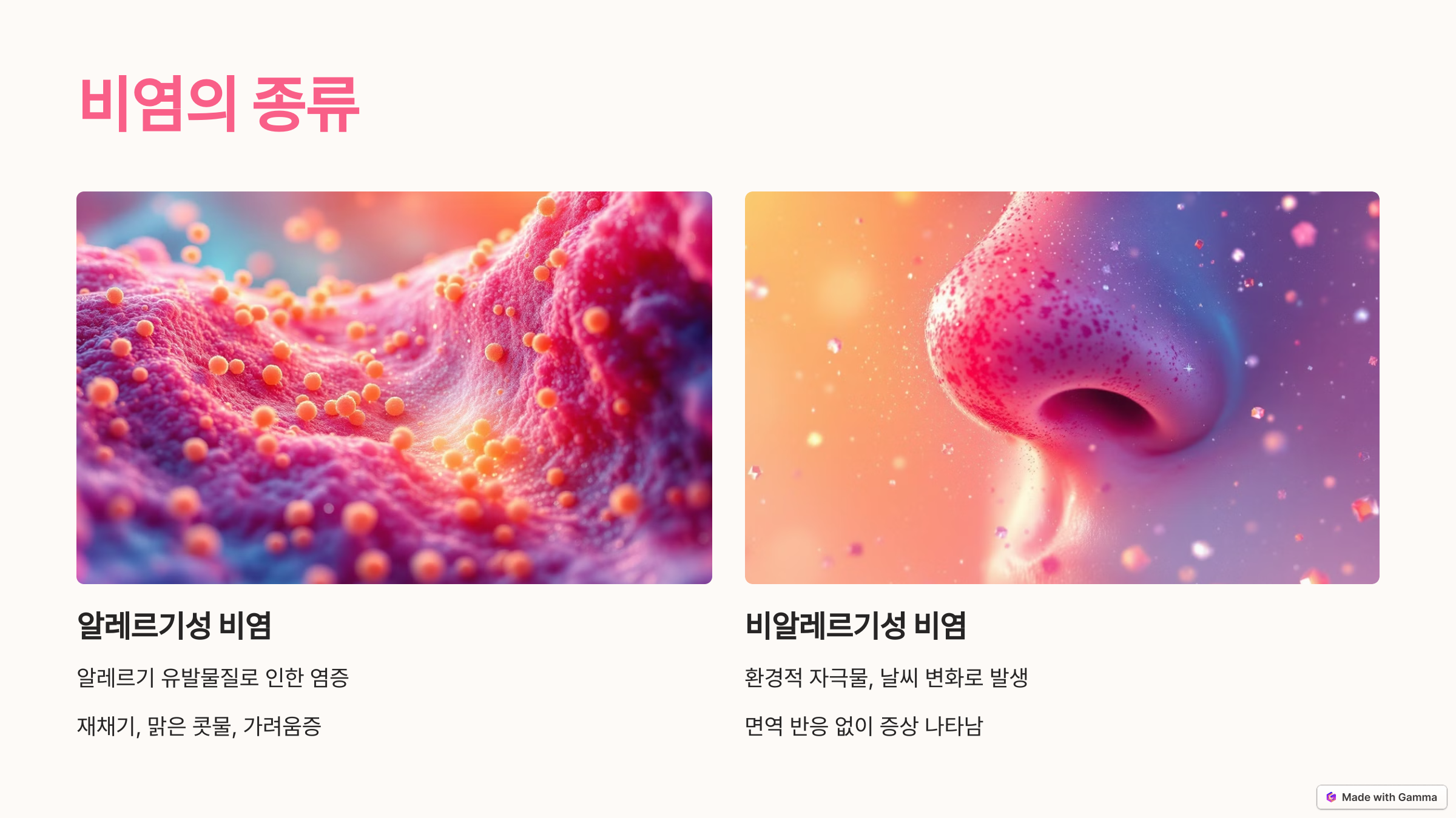 비염의 종류