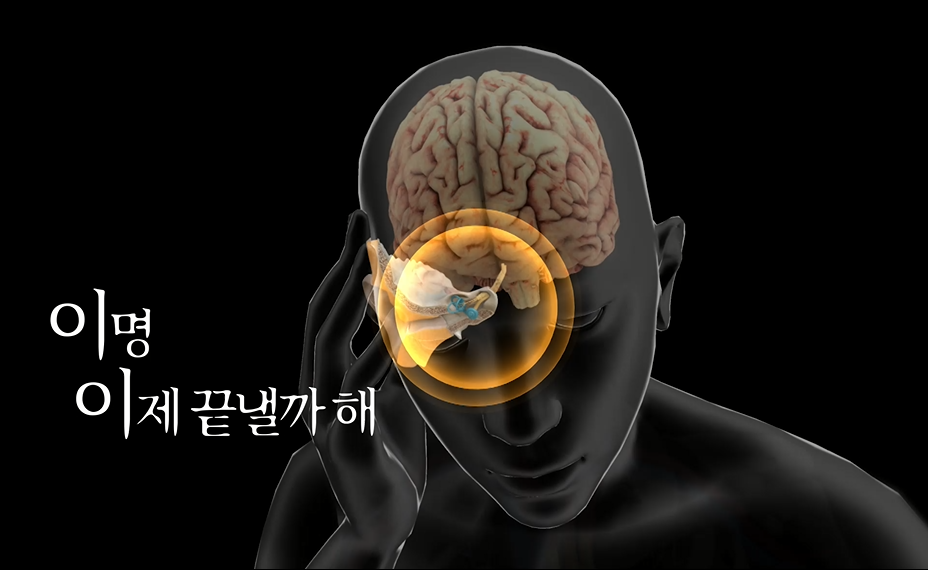 귀에서 삐 소리