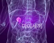콜레스테롤
