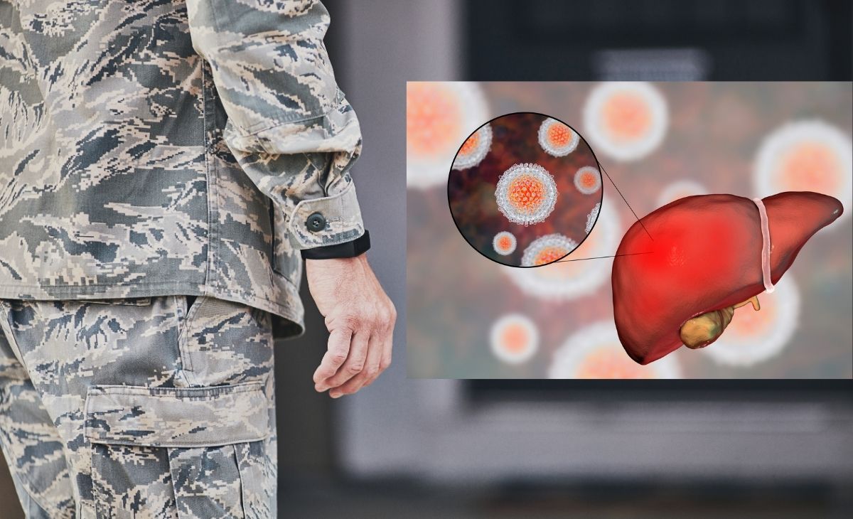 급성 간염과 군면제를 상징하는 이미지2