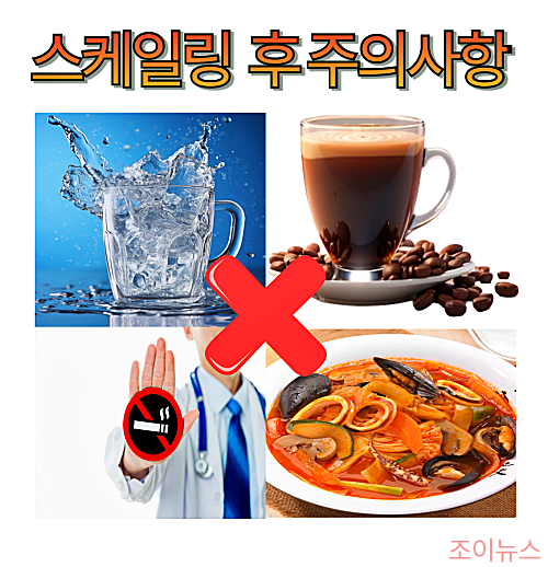 스케일링 후 주의사항