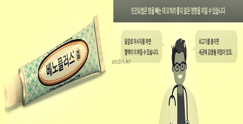 베노플러스겔 효능 효과,성분,가격,부작용 총정리