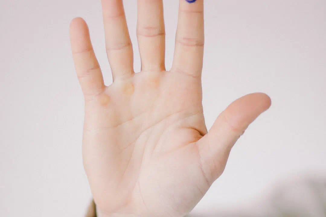  혈당 정상수치 관리 관련사진2