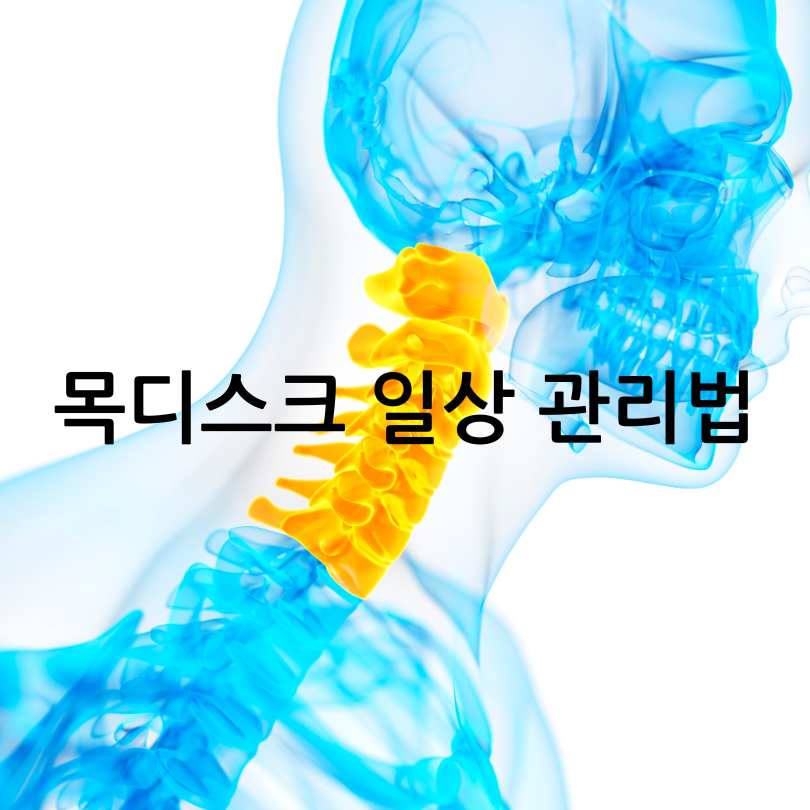 목디스크 증상