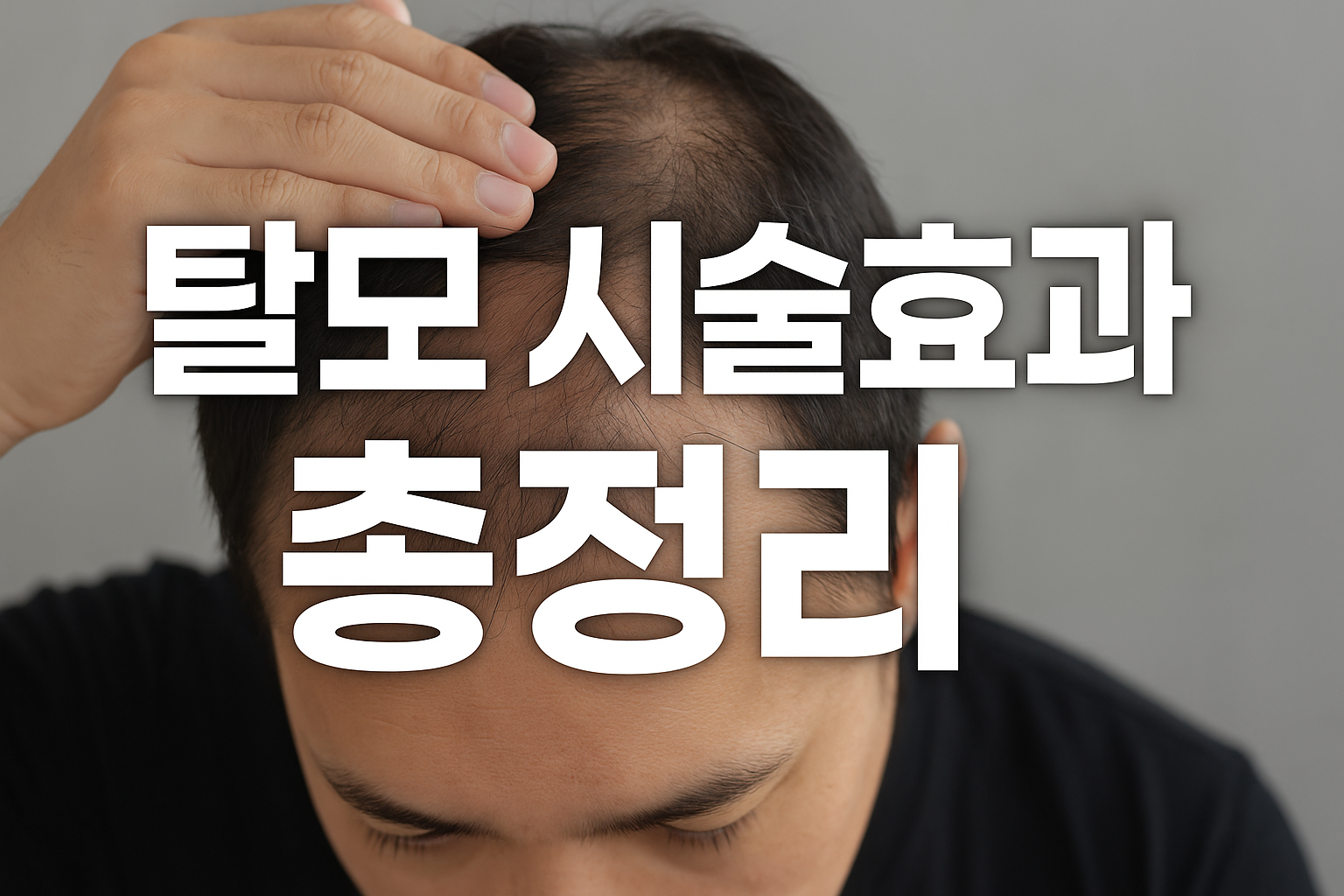 탈모 치료 시술 방법과 결과 비교