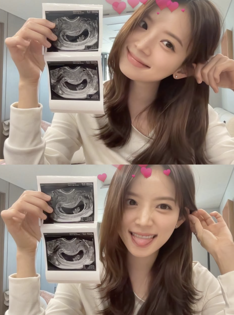 김지영 결혼 전 임신 소식 전하는 모습