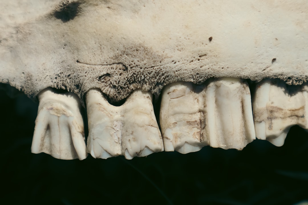 Denture