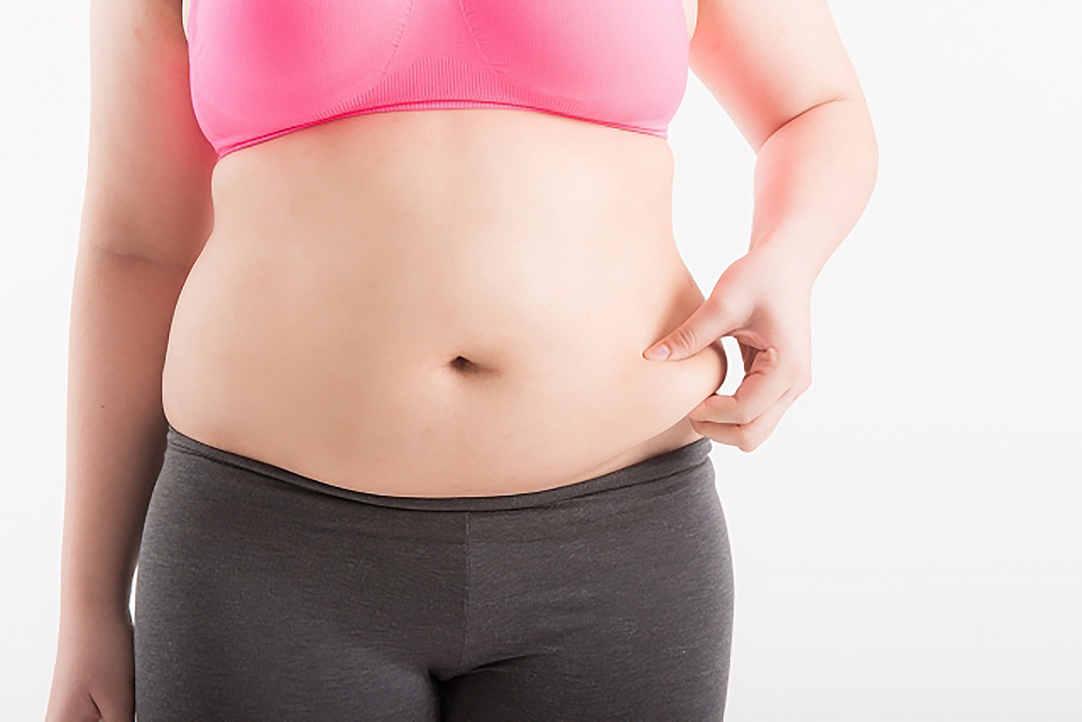 비만이-있는-여성