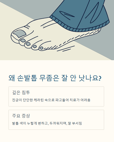 왜 손발톱 무좀은 잘 안 낫나요?