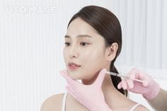 안면거상술
