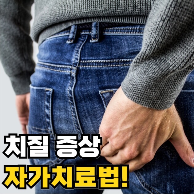 치질 증상 자가치료법