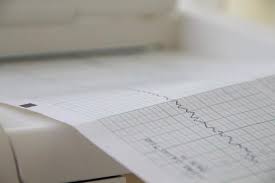 심박수 정상 수치