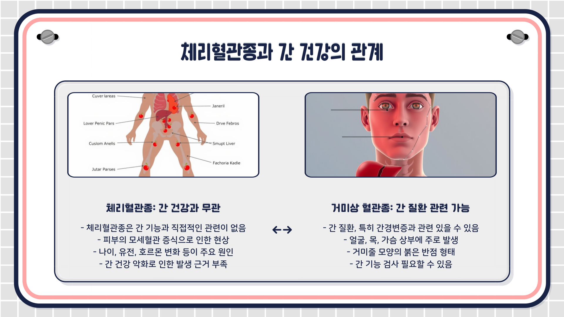 체리혈관종-간건강