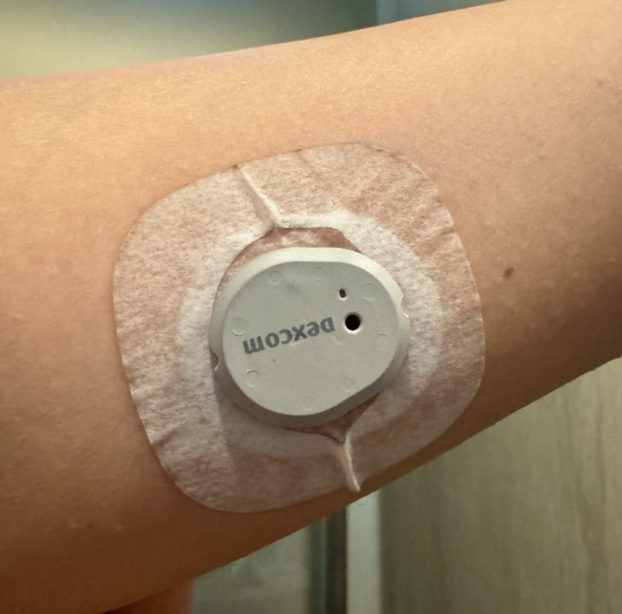 덱스콤 G7 내돈내산 후기