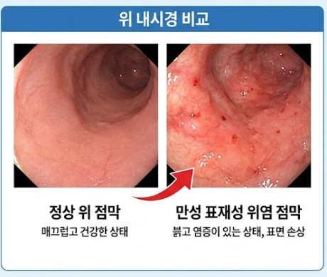 내시경 예시