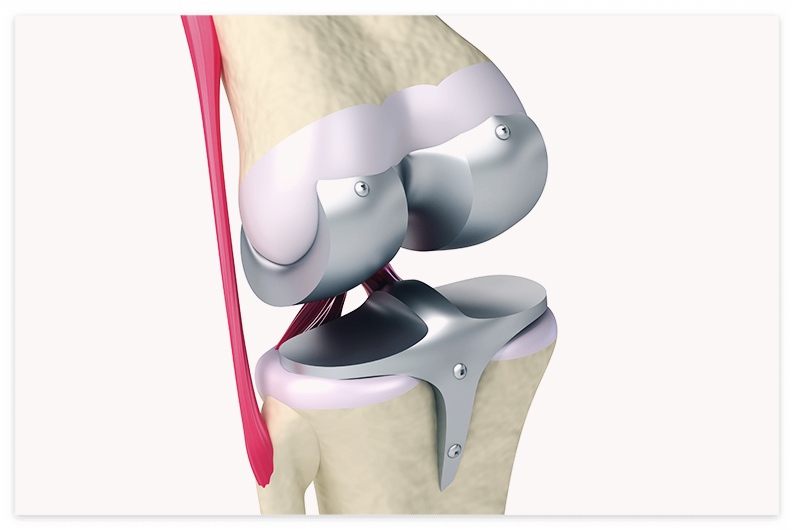 콘드로이친 효능