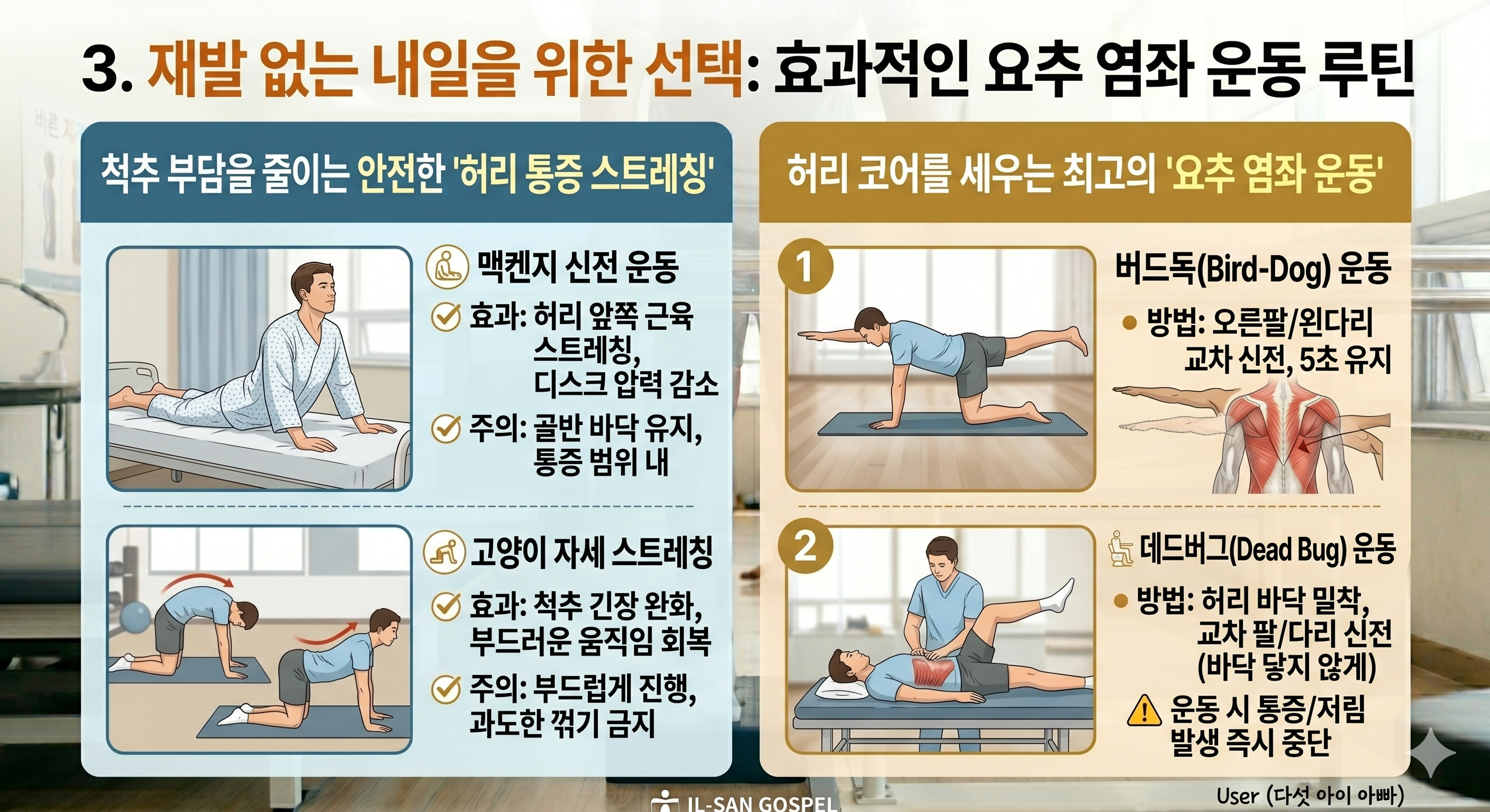 재발 없는 내일을 위한 선택: 효과적인 요추 염좌 운동 루틴
