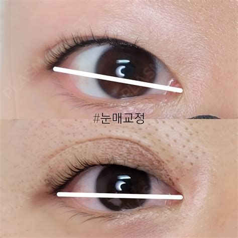 눈꼬리 내리기