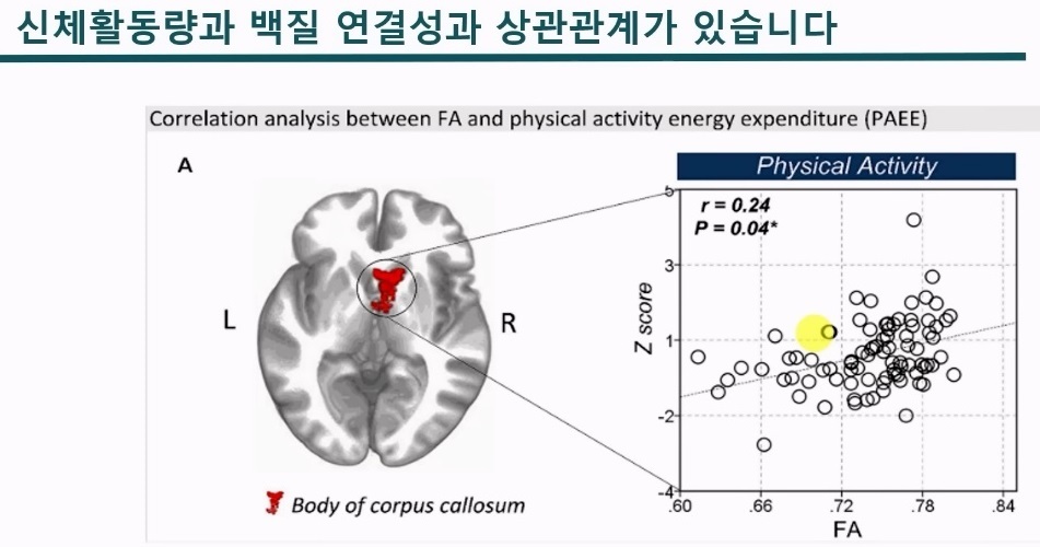 중년의뇌를갖는방법-슈퍼에이저