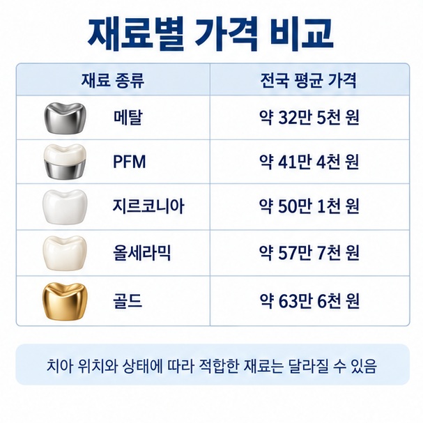 메탈 PFM 지르코니아 올세라믹 골드 크라운의 전국 평균 가격을 비교한 표 형태의 인포그래픽