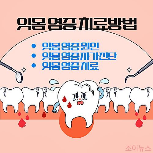잇몸 염증 치료방법, 방치하면 큰일나는 이유