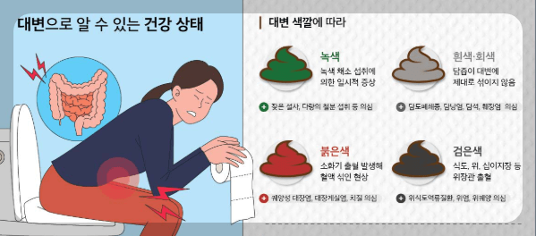 초록색 변 원인과 이유