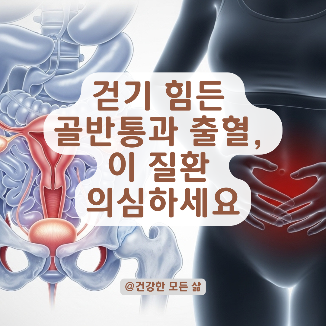 걷기 힘든 골반통과 출혈이 함께 온다면? 자궁·난소 관련 질환 의심 정리.