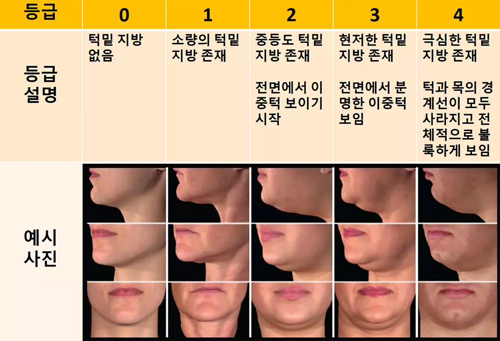 턱선 등급