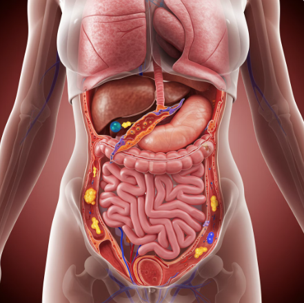 맹장이 터지는 이유