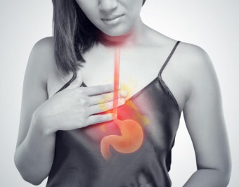 역류성 식도염 치료 및 관리방법 알아보기